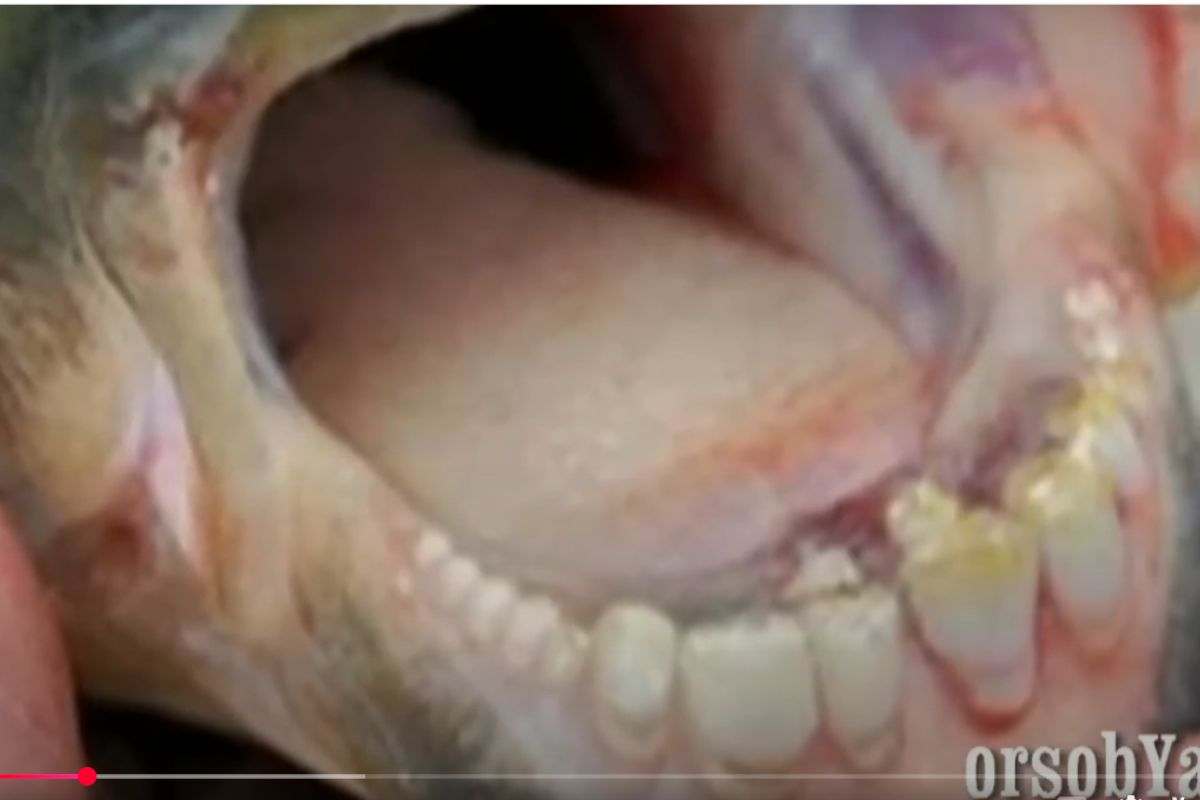 Denti del pesce